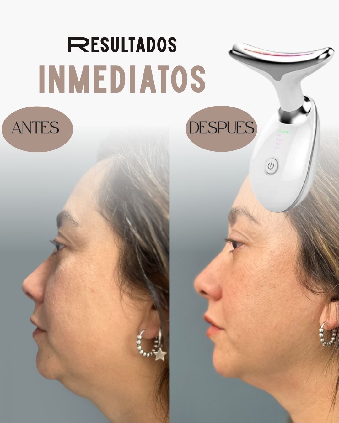 ReafirmaSkin™ – Reduce papada | Mejora circulación facial